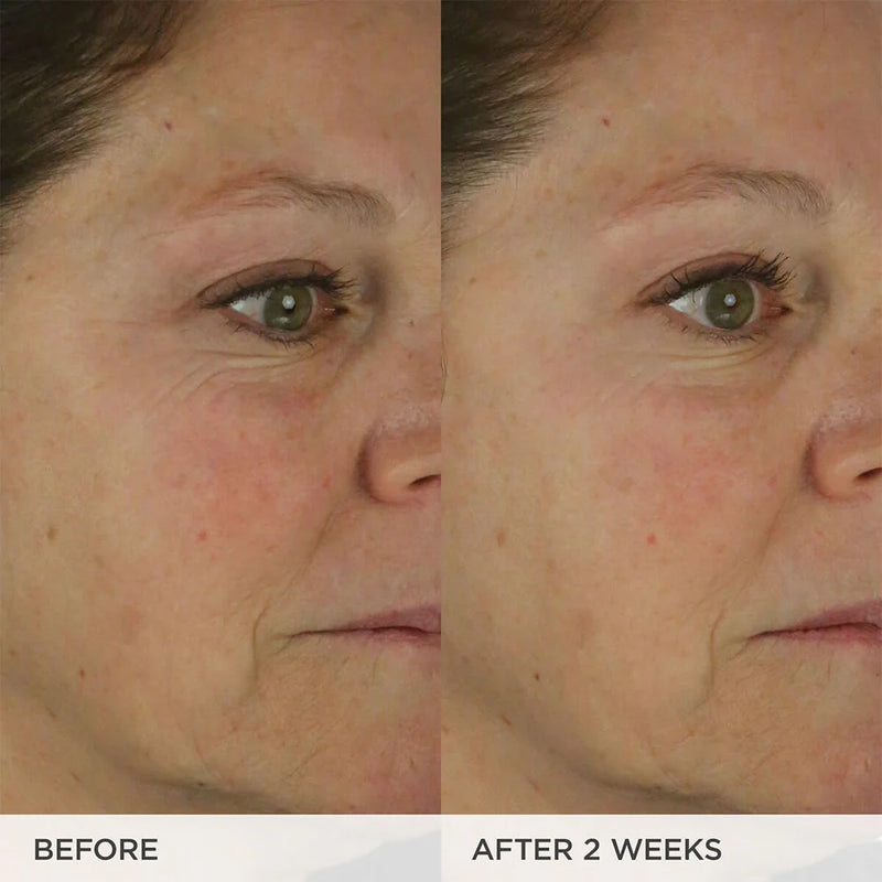 CLINICAL RESULTS
